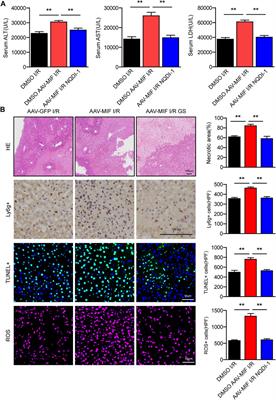 Inhibition of macrophage migration inhibitory factor (MIF) suppresses apoptosis signal-regulating kinase 1 to protect against liver ischemia/reperfusion injury